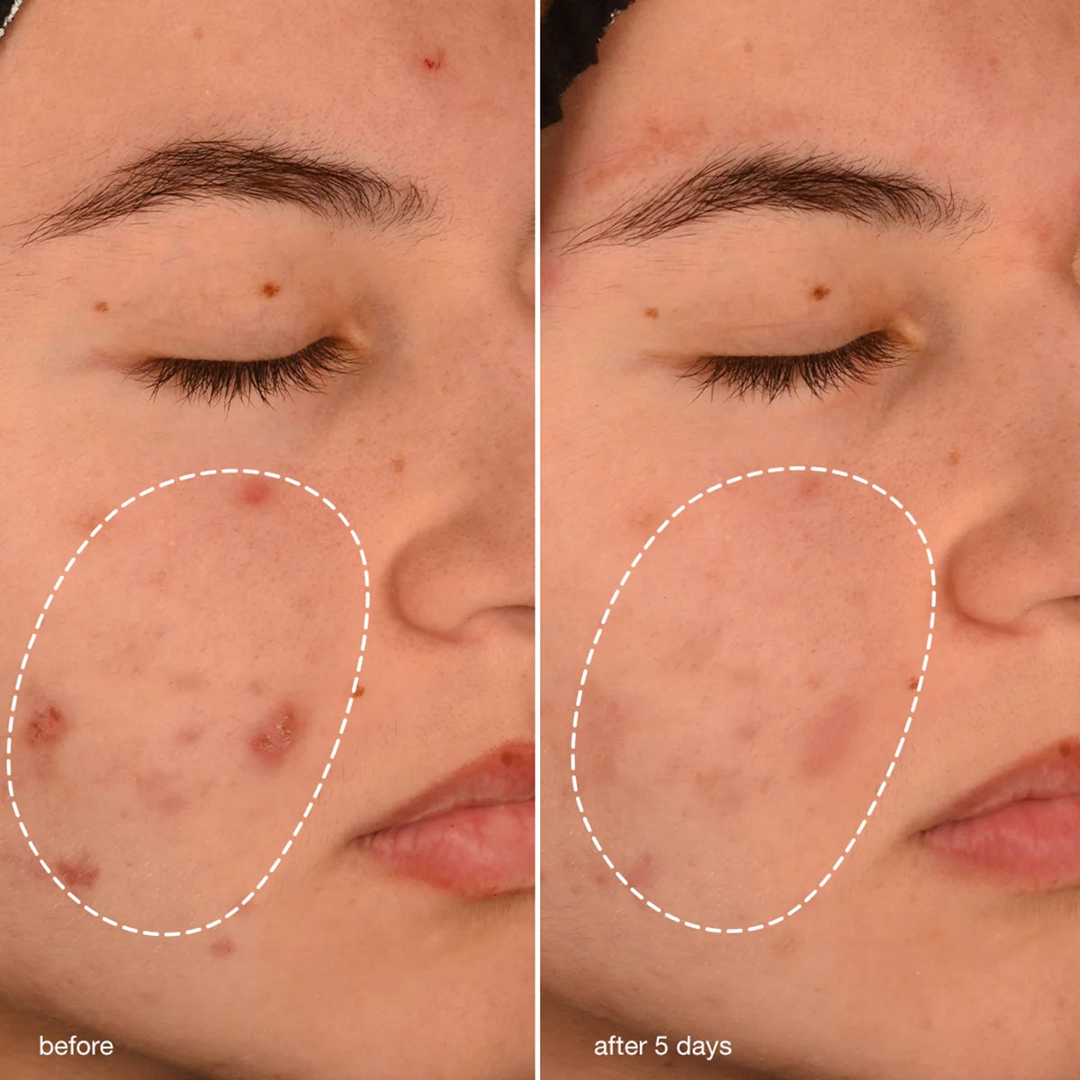 Breakout Biotic Moisturizer